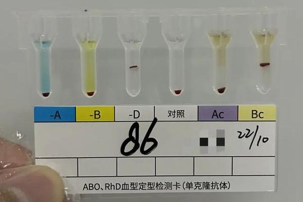 A亚型阳性血型,a型亚型血什么意思