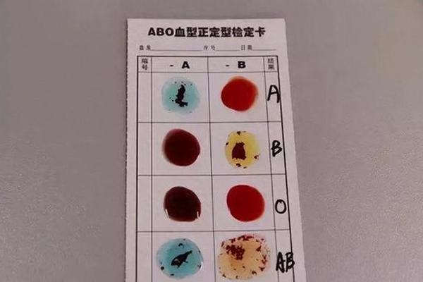 全血a是血型A吗_A一血型是指哪一种血型