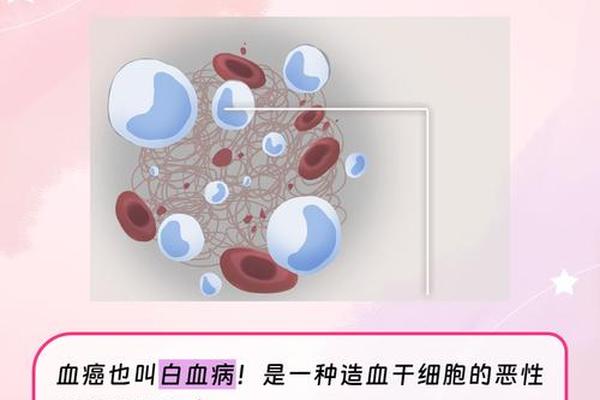 a血型患癌、a型血更容易患癌吗