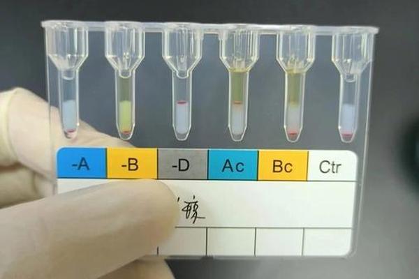 血型正定型A凝集 血清凝集判断血型图
