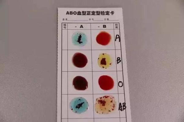 血型吧我就是A3男 a3亚血型有多少人