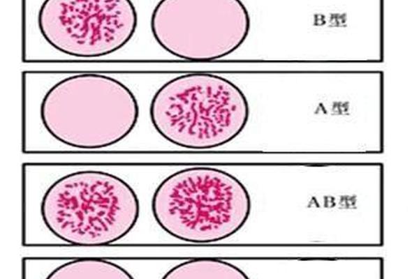 a血型和b血型血清混合(与抗b凝集是什么血型)