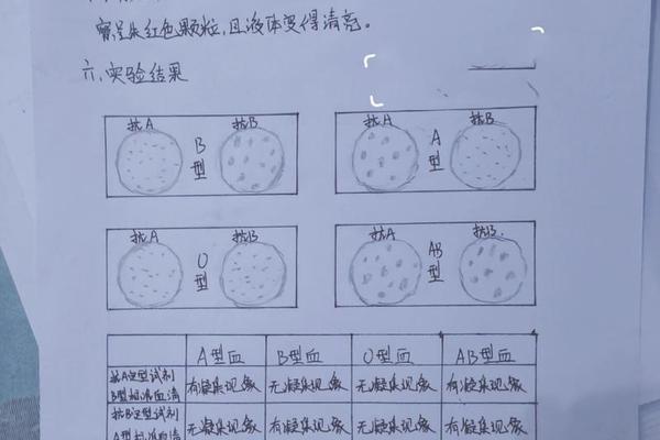 abo血型检测a;abo血型鉴定是什么意思 abo血型检测a;abo血型鉴定是什么意思