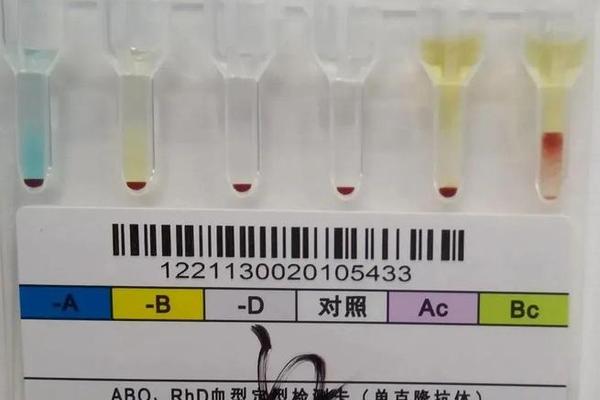 血型A抗原低_ABO血型抗原