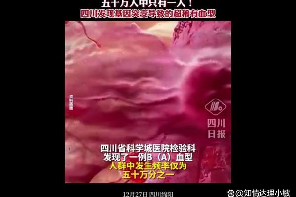 A偏Ab血型,四川发现一例B(A)血型