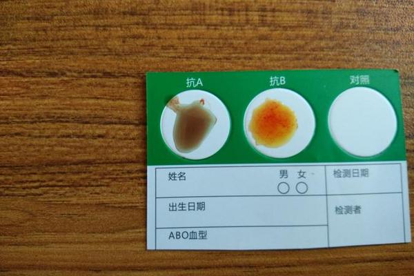 Ig血型抗A_血型抗A