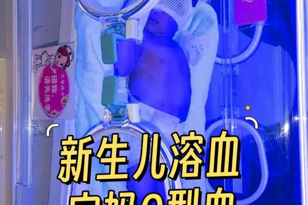 0血型合A黄疸(黄疸与o型血有关系吗)