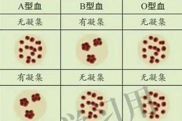 a血型的人含a凝集原;血清中只含有抗A凝集素的血型是
