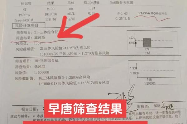 孕妇血型A阴性 孕妇血型抗体筛查阴性是什么意思