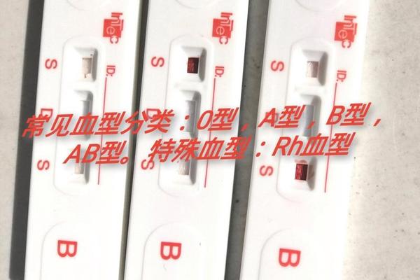 a血型孩子聪明_ab型血为什么叫聪明血