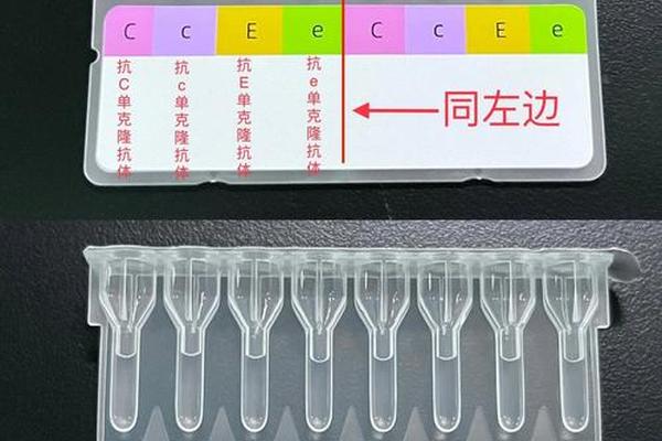 血型测定抗A凝集为什么血型 抗a抗b都不凝集是什么血型 血型测定抗A凝集为什么血型 抗a抗b都不凝集是什么血型