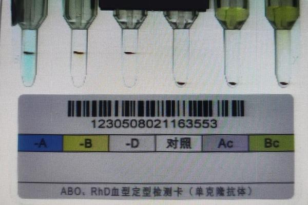a血型抗原;A型血有A抗体吗