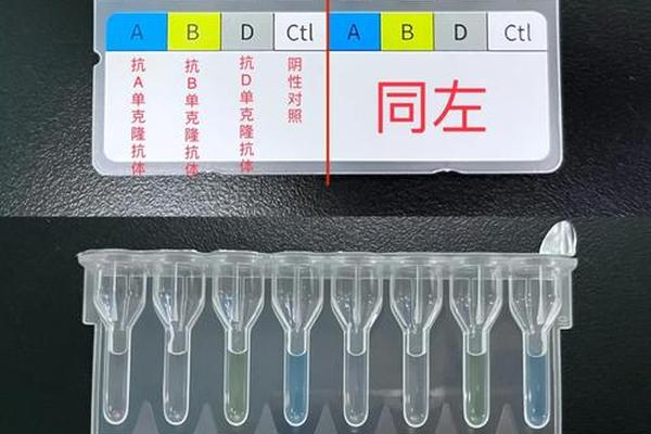 血型微柱凝集法A型—血型微柱法是什么茶什么的