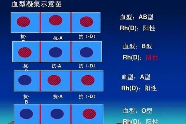 血型a 有什么疾病,a型血是常见血型吗