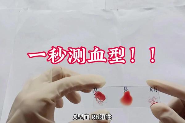 血型A是RH阳性(rh阳性血型属熊猫血吗)
