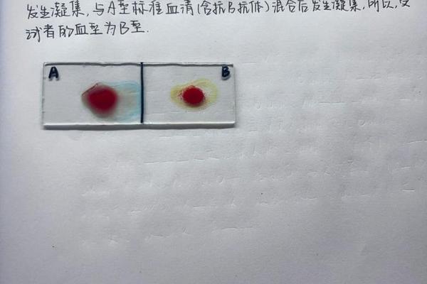 abo血型显示a血型是(ABO血型划分的根据是)