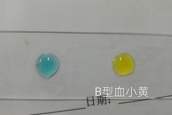 a血型会使b血型发生凝集吗 四种血型的凝集关系