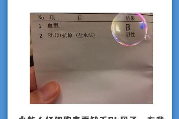 血型最早是a型,a型rh阳性是熊猫血吗