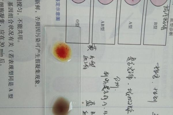 血型a标准试剂_ABO血型鉴定凝集反应