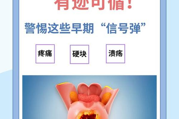舌癌多为A型血型 舌癌最常见的分型