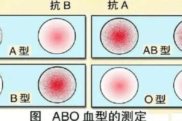 抗a血型就是a吗-抗a是什么血型
