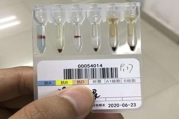 扛a血型定型试剂-抗A抗B试剂测定准确吗