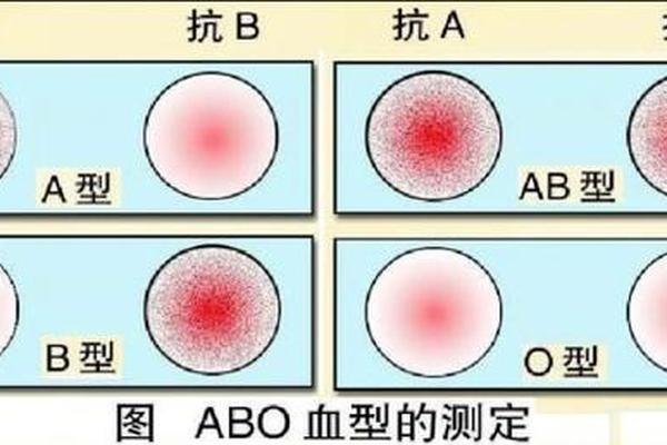 张a血型_a+血型是AA还是AO