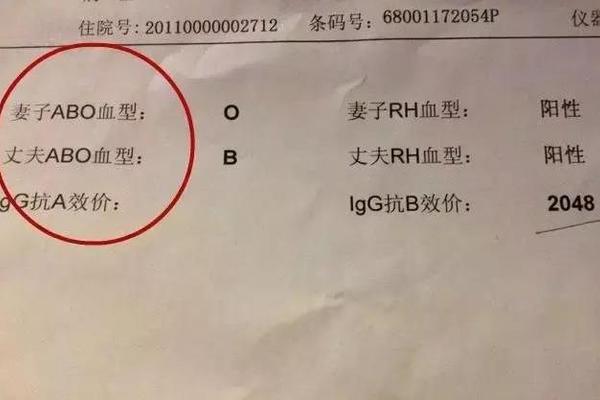 a血型不婚主义_老公是A型我是O型血检查溶血