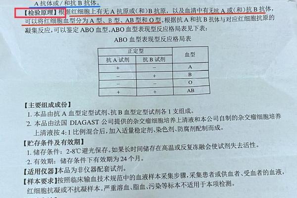 血型a释放试验抗a,抗a血型定型试剂原理 血型a释放试验抗a,抗a血型定型试剂原理