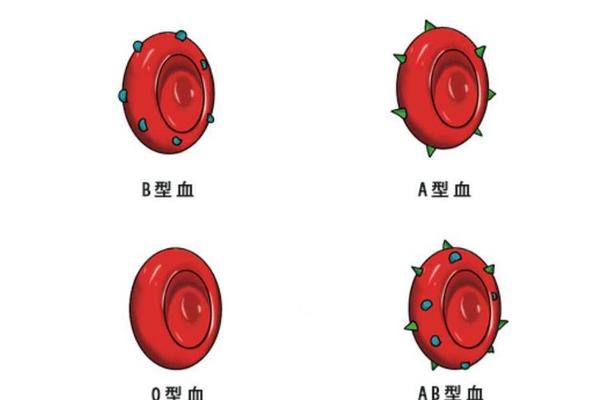 双份a血型;两个血腥o可以生出AB吗