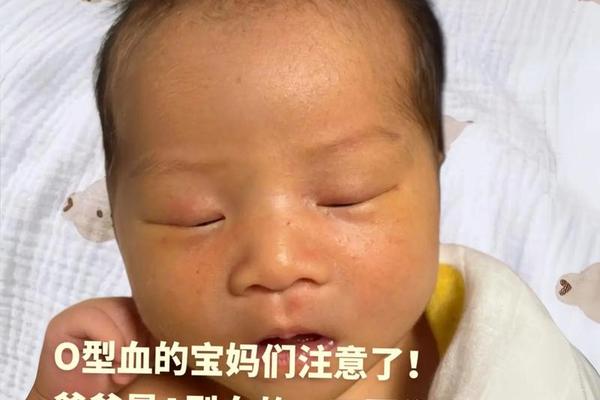 宝宝a b血型妈妈a型;AB型血为什么不是汉族人