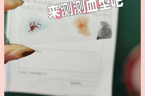 血型A后面q_A型血怎么区分A+还是A- 血型A后面q_A型血怎么区分A+还是A-