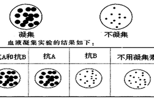 抗a血清凝集是a血型还是b血型、某人的血液与抗A凝集