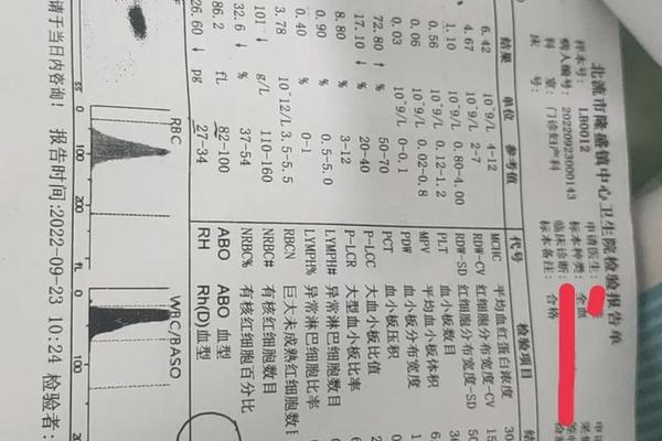 a3血型是稀有血型吗 a十型血是熊猫血吗