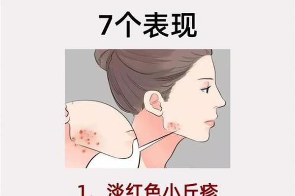 a血型尖锐是什么意思(hpv哪几个型号是尖锐)