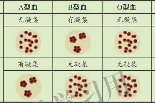 abo血型鉴定a(ABO是什么血型)