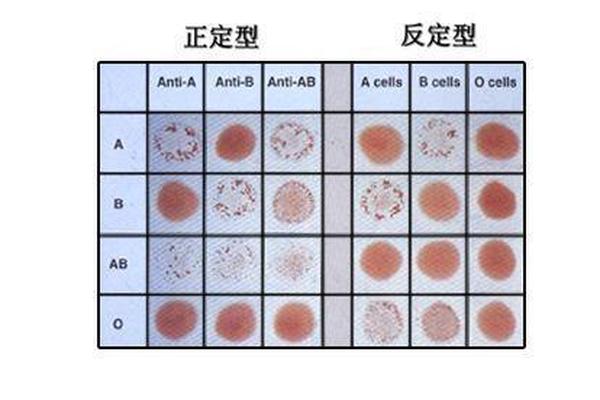 血型反定型为a,最古老的血型是a型