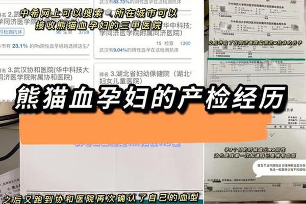 血型检测结果a rh-a型血rh阴性是熊猫血吗