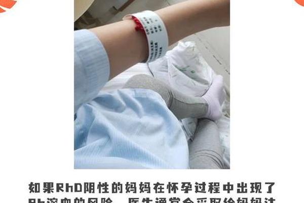rhd血型异常提示A,A型血RH阳性要警惕了