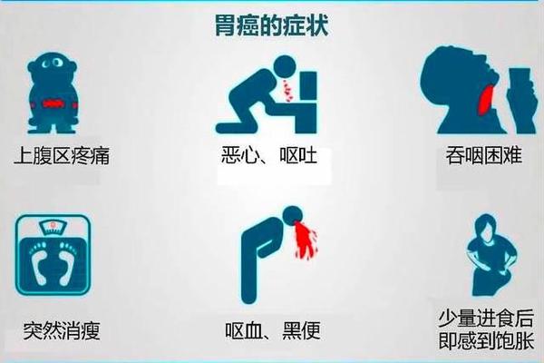 a血型容易得胃癌-什么血型容易患胃癌