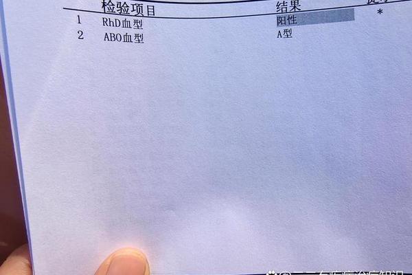 A血型RDH血型阳性什么意思、rhd阳性是什么意思