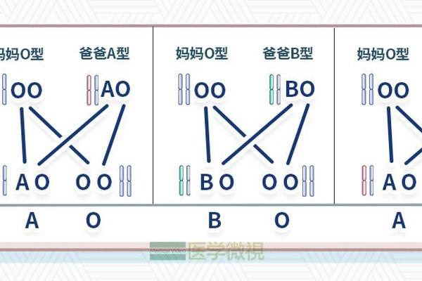 妈妈血型o爸爸血型a,妈妈AB型血爸爸o型血