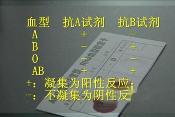 抗a抗b血型定型试剂 单克隆抗体、什么是单克隆抗体