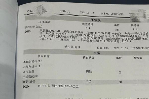 a血型rhd阳性不是熊猫血型-o型rhd阳性熊猫