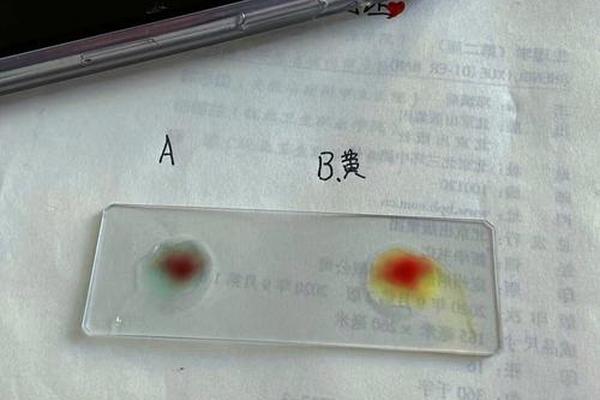 抗a溶液测血型;与抗a血清凝集是什么血型 抗a溶液测血型;与抗a血清凝集是什么血型