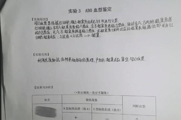 abo血型鉴定是a_血型亲子鉴定对照表