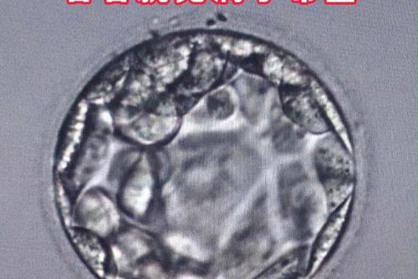 4a囊胚孩子是什么血型-囊胚4aa是不是很挑子宫