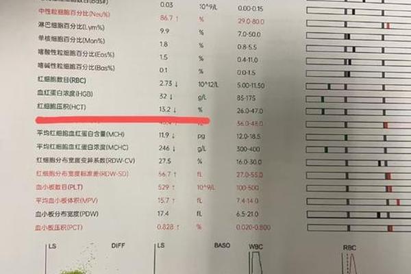 A血型CCDee正常吗;化验单上CCee血型什么意思
