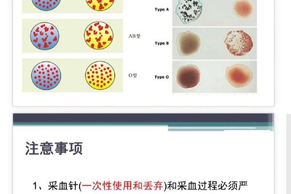 血型抗a结果;血型鉴定凝集口诀