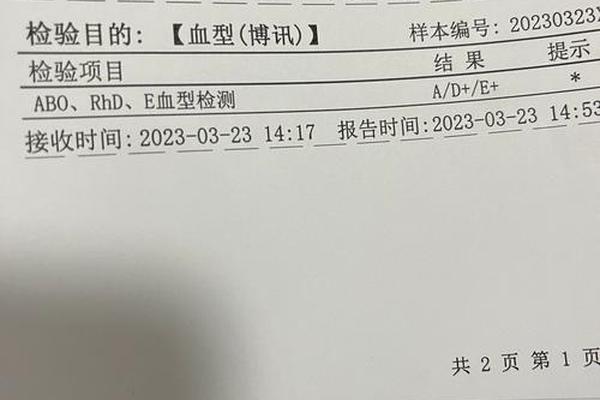 正定血型为A—ABO血型正定型结果是A